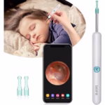 گوش پاک کن هوشمند شیائومی Bebird R1